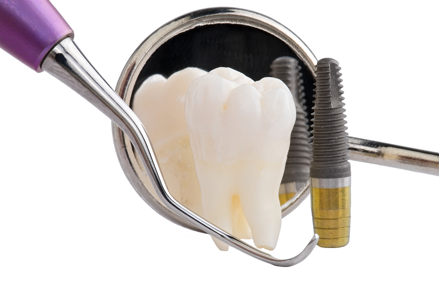 Dental Implants North Atlanta